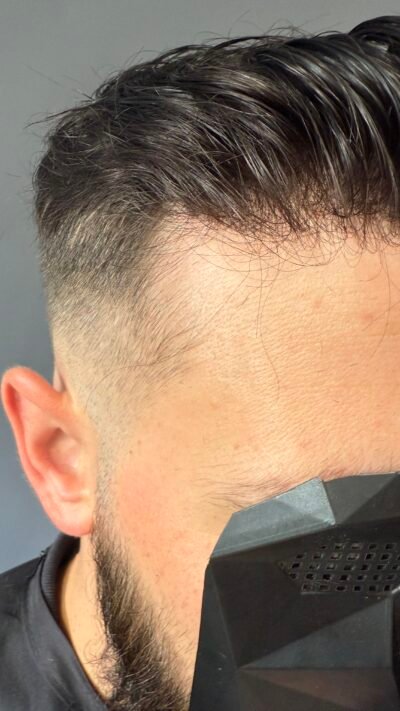 Vue du haut gauche de la tête montrant une bordure frontale nette et indétectable avec complément capillaire naturel – Capillexpert