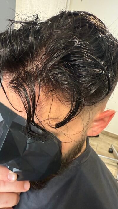 Homme avec cache visage Fade Up Anonymous montrant un complément capillaire parfaitement naturel et indétectable – Capillexpert